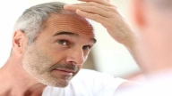 8 Best Hair Loss Treatment for Men in 2021